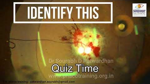 Quiz Time: Identify this  Dr Sourabh Patwardhan