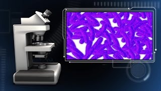 What you need to know about flesh-eating bacteria