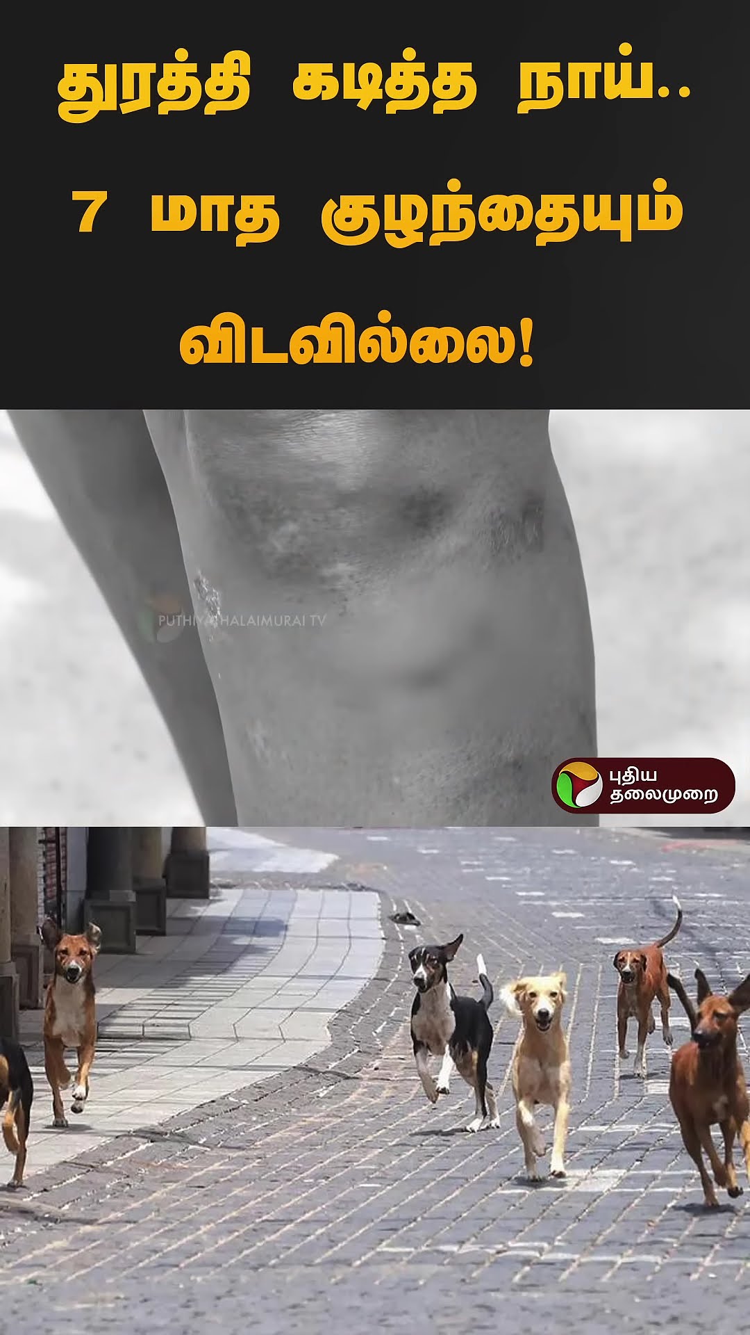 துரத்தி துரத்தி கடித்த நாய்..7 மாத குழந்தையும் விடவில்லை! VELACHERY DOG Bite | #shorts