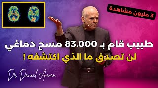 هذا الطبيب قام بإجراء أكثر من 83.000 مسح دماغي وما اكتشفه سوف يصيبك بالذهول