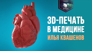 3D печать в медицине. Илья Квашенов.  Лекторий SciTopus