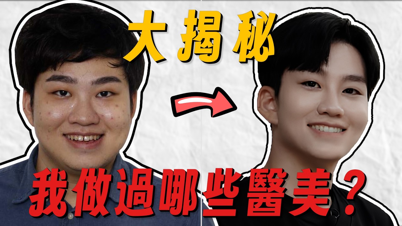 我做過哪些醫美？多年整形心得大公開！鳳凰電波、雙音波、肉毒、皮秒雷射、玻尿酸、消脂針【Joeman】