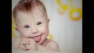 Enerya 21 Mart Dünya Down Sendromu Farkındalık Günü