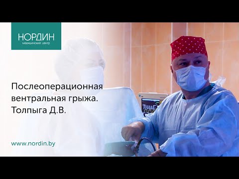 Послеоперационная вентральная грыжа: почему образуется грыжа после операции