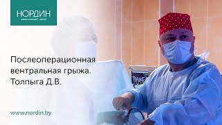 Послеоперационная вентральная грыжа: почему образуется грыжа после операции