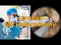 Lumbar Microdiscectomy