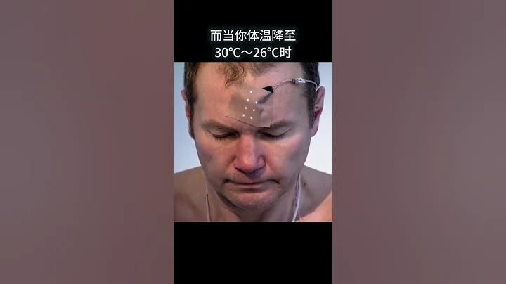 人在凍死前為什麽會脫衣服並露出微笑？ #漲知識 - 天天要聞