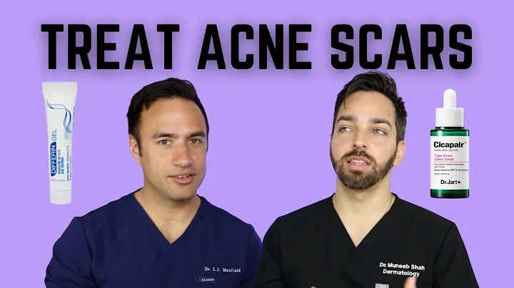 HOW TO TREAT ACNE SCARS | DOCTORLY - DayDayNews