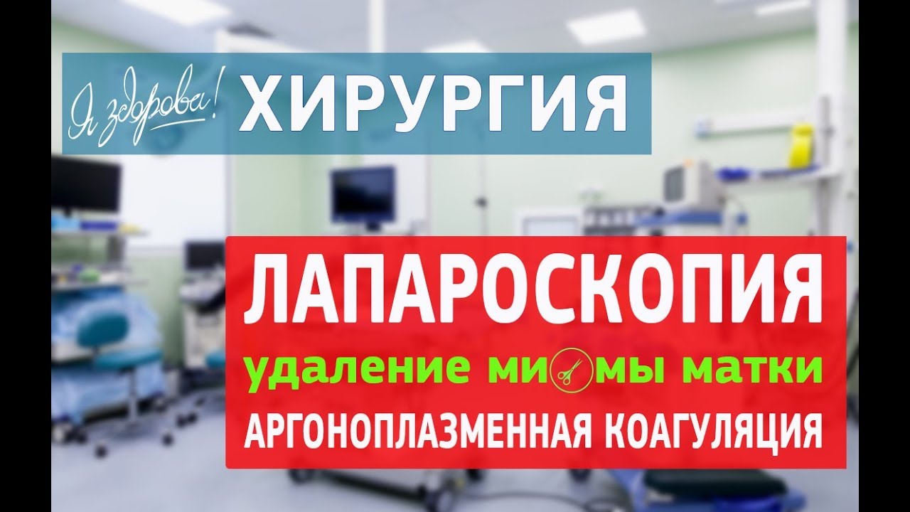Лапароскопия. Удаление миомы матки. Аргоноплазменная коагуляция