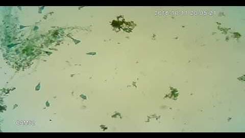 Looking at Stentor through a microscope