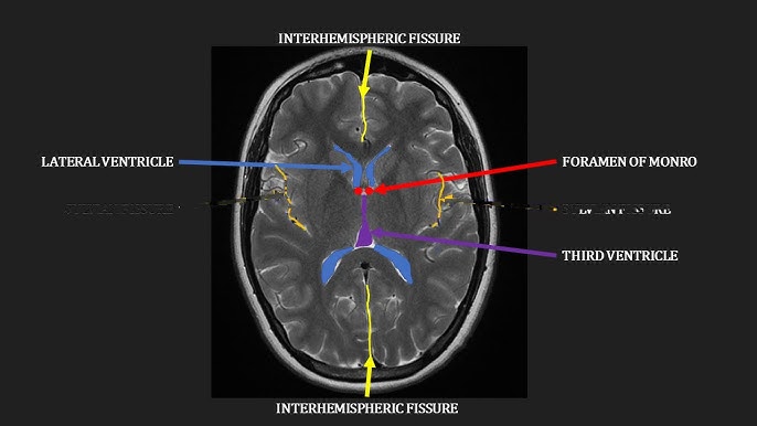 Mri Brain Anatomy mri-brain-anatomy