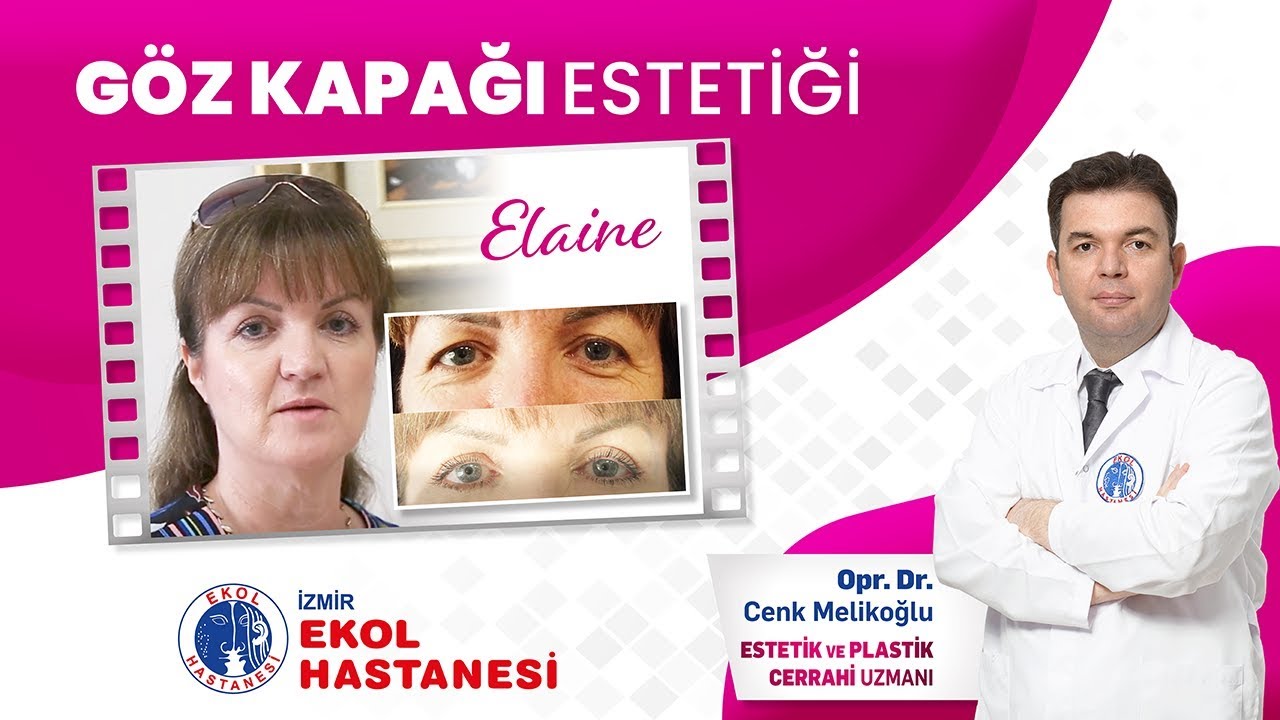 İzmir Ekol Hastanesi - Göz Kapağı Ameliyatı - Opr. Dr. Cenk Melikoğlu -  YouTube