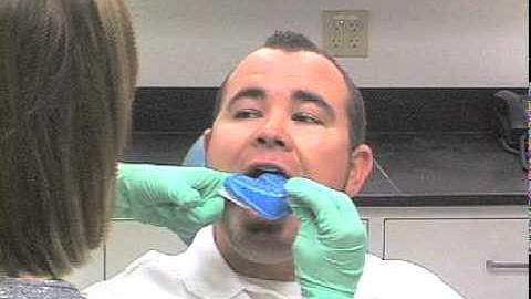 PlanetSmiles How-To Passport PVS Impression Video