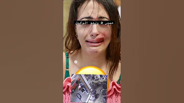 المؤثرة المشهورة ساري كول تتعرض للاعتداءsari Cool في ايطاليا 