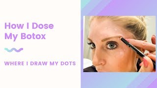 How I Dose my Botox | Where I Draw My Dots