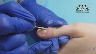 Аппаратный маникюр. Восстановление ногтя акрилом. Аллергия на гель-лак. Протезирование ногтей(, 2017-05-22T19:47:35.000Z)