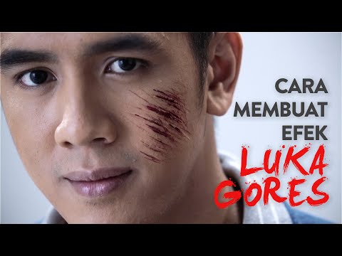 Video: Cara Mendandani Luka (dengan Gambar)