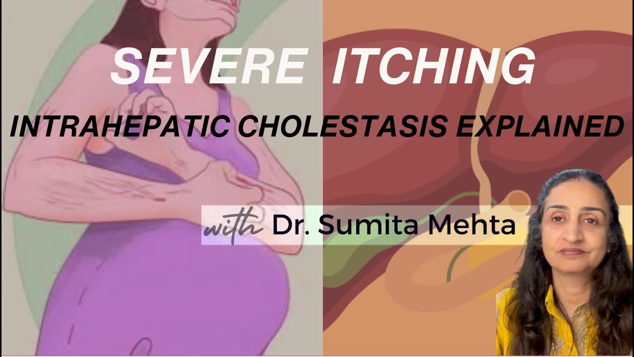 Itching in Pregnancy? Intrahepatic Cholestasis of Pregnancy (ICP) Explained