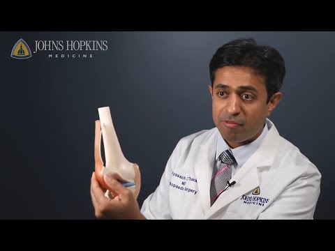   Knee Replacement Surgery