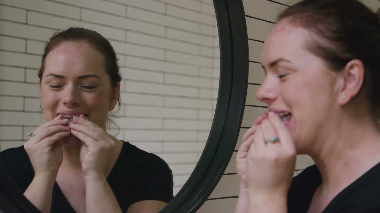 My very first day of invisalign - how to accelerate invisalign treatment