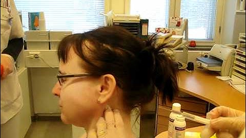 Trigger point injection treatment for tinnitus, part 3