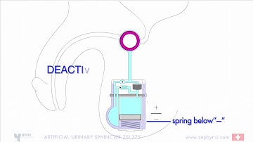 ZSI 375 8A DURING IMPLANTATION DEACTIVATION INSIDE BODY ENGLISH