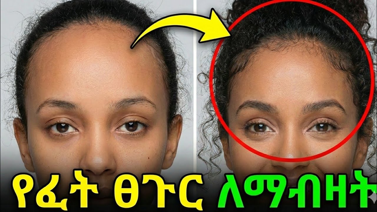 ጥቅጥቅ ያለ የፊት ፀጉር  እንዲኖርሽ የሚያደርግ  ምርጥ ሲስተም