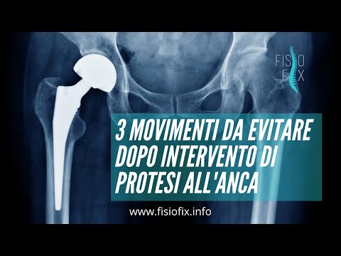 Video: Chi ha un impatto sull'anca?