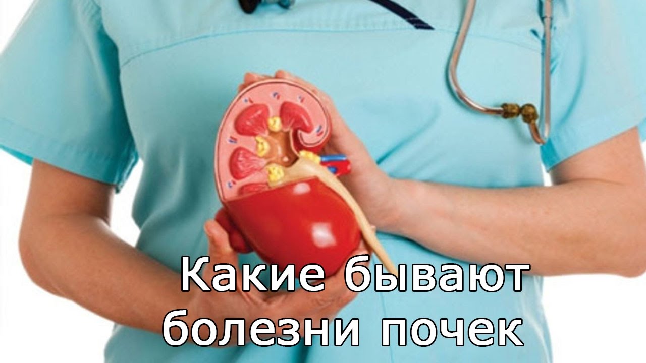 Какие бывают заболевания почек - YouTube