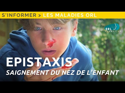 Vidéo: 4 façons d'arrêter de sonner nasal