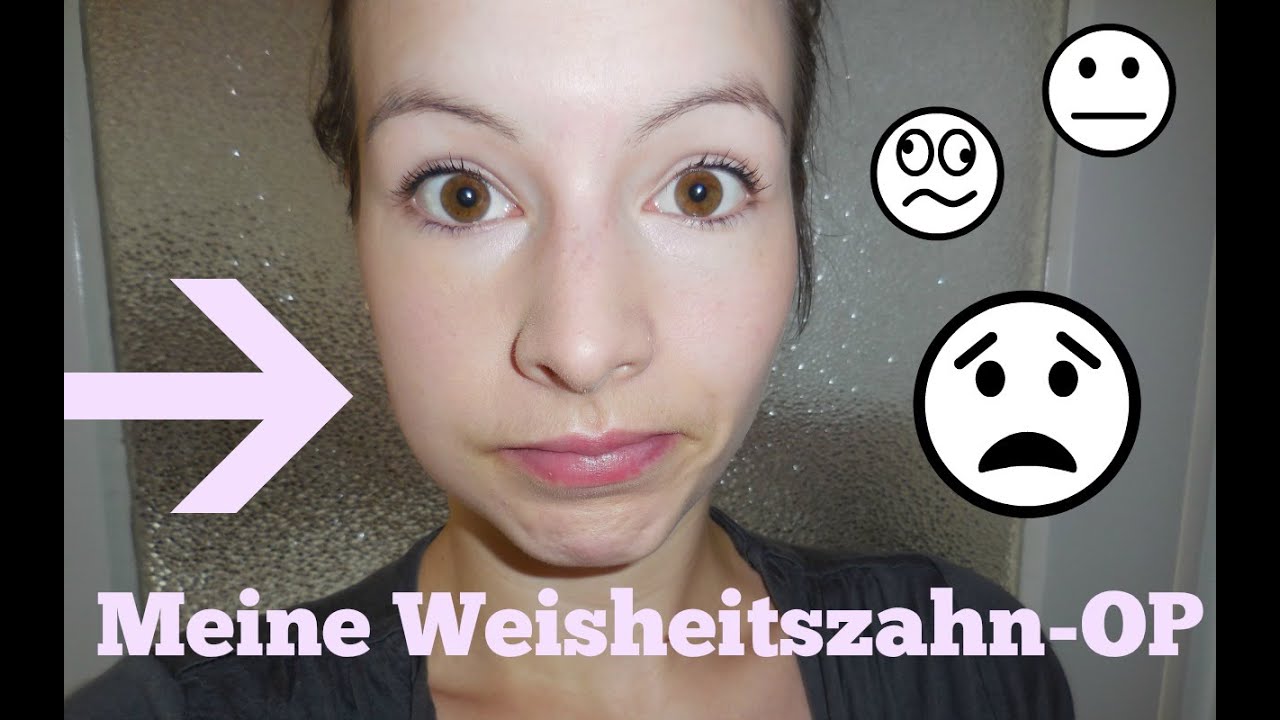Meine Weisheitszahn Operation - FMA I AnnaBirdie
