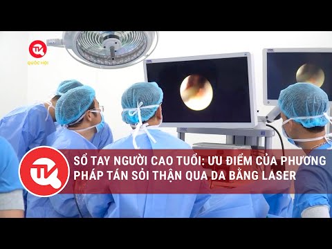 Sổ tay người cao tuổi: Ưu điểm của phương pháp tán sỏi thận qua da bằng laser