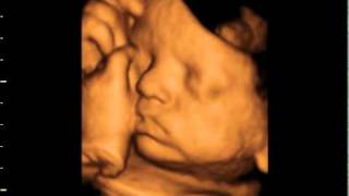 3d 4d ultrasound at 36 weeks GoldenView Ultrasound