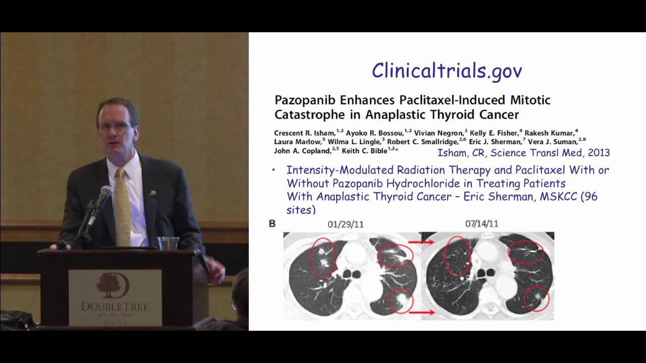 Anaplastic Thyroid Cancer Discussion, Questions, Answers. Dr. Haugen