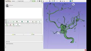 Making a mesh - 3D Slicer
