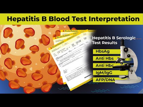Videó: Megjelenik a hepatitis egy rutin vérvizsgálat során?