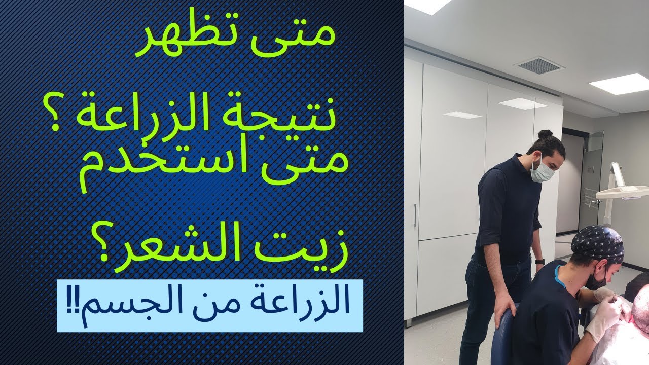 متى تظهر نتائج زراعة الشعر؟ متى استخدم الزيت على الشعر المزروع؟ هل تنصح بالزراعة من الجسم؟
