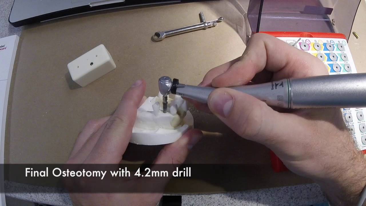 Nobel Hands On Implant Demo Replace Tapered YouTube