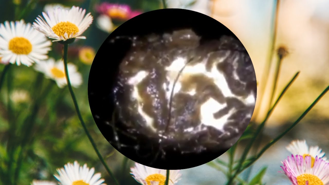 Ear Wax Disgusting ear removal 0010 YouTube