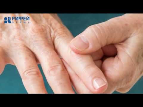 здоровье артрит отдалились