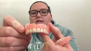 Comparing my temporary dentures | Why I went to affordable dentures