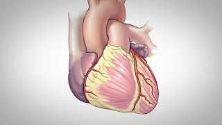 Coronary Artery Bypass Surgery Resimi
