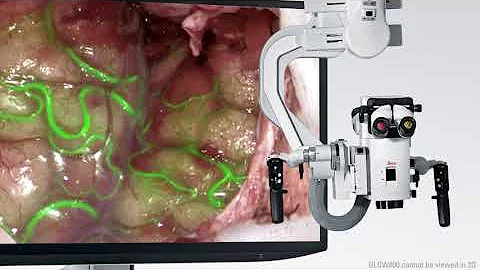 Discover the ARveo digital Augmented Reality microscope