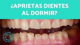 ¿Aprietas DIENTES al DORMIR? Causas y SOLUCIONES para el BRUXISMO