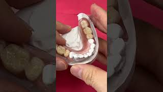 Upper and Lower Partials
