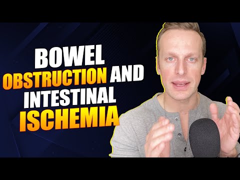 Bowel obstruction and Intestinal Ischemia -- Dr. Hilsden&rsquo;s online lecture on these conditions