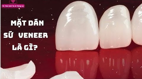 Mặt dán sứ veneer là gì | Tt niềng răng quốc tế Diamond