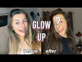 EXTREME GLOW UP transformation *i look completely different* | braces off & hair dyed