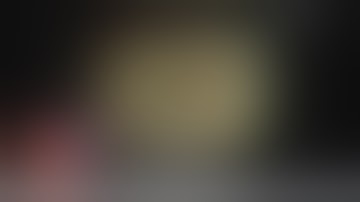 Diagnosing PSC Using Cholangioscopy by Dr. Komanduri