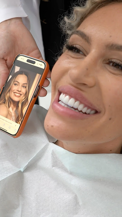 Veneer Transformation, Just like Margot Robbie's! #hollywoodsmile #veneers #dentalshorts